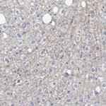 Nectin 2 Antibody in Immunohistochemistry (Paraffin) (IHC (P))