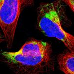 Bit1 Antibody in Immunocytochemistry (ICC/IF)