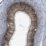 Bit1 Antibody in Immunohistochemistry (Paraffin) (IHC (P))