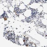 CD42b Antibody in Immunohistochemistry (Paraffin) (IHC (P))