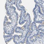 CD42b Antibody in Immunohistochemistry (Paraffin) (IHC (P))