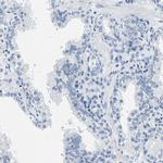 CD42b Antibody in Immunohistochemistry (Paraffin) (IHC (P))