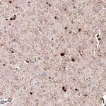 ROBO2 Antibody in Immunohistochemistry (Paraffin) (IHC (P))