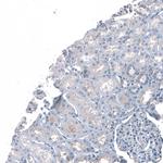 ROBO2 Antibody in Immunohistochemistry (Paraffin) (IHC (P))