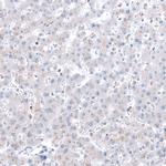 ROBO2 Antibody in Immunohistochemistry (Paraffin) (IHC (P))