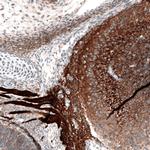 ROBO2 Antibody in Immunohistochemistry (Paraffin) (IHC (P))