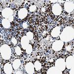 Annexin A3 Antibody in Immunohistochemistry (Paraffin) (IHC (P))