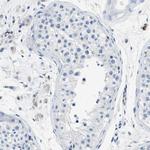 Annexin A3 Antibody in Immunohistochemistry (Paraffin) (IHC (P))