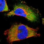 Annexin A3 Antibody in Immunocytochemistry (ICC/IF)