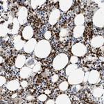 Annexin A3 Antibody in Immunohistochemistry (Paraffin) (IHC (P))