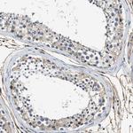 Annexin A3 Antibody in Immunohistochemistry (Paraffin) (IHC (P))