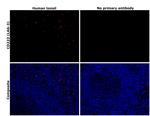 CD223 Antibody in Immunohistochemistry (Paraffin) (IHC (P))