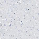 CD223 Antibody in Immunohistochemistry (Paraffin) (IHC (P))