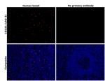 CD223 Antibody in Immunohistochemistry (Paraffin) (IHC (P))