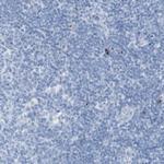 CD223 Antibody in Immunohistochemistry (Paraffin) (IHC (P))