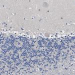 CYP2C8 Antibody in Immunohistochemistry (Paraffin) (IHC (P))