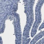 CYP2C8 Antibody in Immunohistochemistry (Paraffin) (IHC (P))