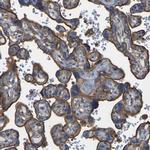 IQGAP1 Antibody in Immunohistochemistry (Paraffin) (IHC (P))