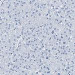 Calponin 1 Antibody in Immunohistochemistry (Paraffin) (IHC (P))