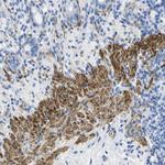 Calponin 1 Antibody in Immunohistochemistry (Paraffin) (IHC (P))