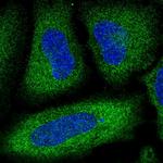 PDE3A Antibody in Immunocytochemistry (ICC/IF)