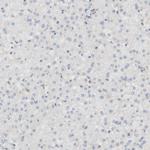 PDE3A Antibody in Immunohistochemistry (Paraffin) (IHC (P))