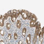 PDE3A Antibody in Immunohistochemistry (Paraffin) (IHC (P))