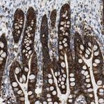 MARCH8 Antibody in Immunohistochemistry (Paraffin) (IHC (P))