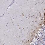 NEFL Antibody in Immunohistochemistry (Paraffin) (IHC (P))