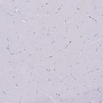 NEFL Antibody in Immunohistochemistry (Paraffin) (IHC (P))