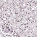 PTPN2 Antibody in Immunohistochemistry (Paraffin) (IHC (P))