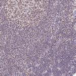 PTPN2 Antibody in Immunohistochemistry (Paraffin) (IHC (P))