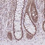 PTPN2 Antibody in Immunohistochemistry (Paraffin) (IHC (P))