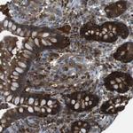 MTHFD1 Antibody in Immunohistochemistry (Paraffin) (IHC (P))