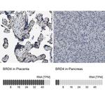 BRD4 Antibody