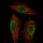 BRD4 Antibody in Immunocytochemistry (ICC/IF)