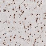 BRD4 Antibody in Immunohistochemistry (Paraffin) (IHC (P))