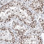 BRD4 Antibody in Immunohistochemistry (Paraffin) (IHC (P))