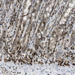 LOK Antibody in Immunohistochemistry (Paraffin) (IHC (P))