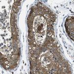 LOK Antibody in Immunohistochemistry (Paraffin) (IHC (P))