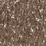 GPRC5B Antibody in Immunohistochemistry (Paraffin) (IHC (P))