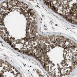 GPRC5B Antibody in Immunohistochemistry (Paraffin) (IHC (P))