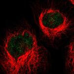 HLTF Antibody in Immunocytochemistry (ICC/IF)