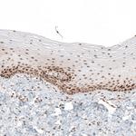 HLTF Antibody in Immunohistochemistry (Paraffin) (IHC (P))