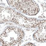 HLTF Antibody in Immunohistochemistry (Paraffin) (IHC (P))