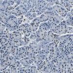 BNIP3L Antibody in Immunohistochemistry (Paraffin) (IHC (P))