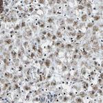 BNIP3L Antibody in Immunohistochemistry (Paraffin) (IHC (P))