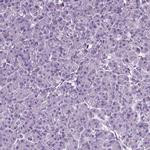 CD109 Antibody in Immunohistochemistry (Paraffin) (IHC (P))