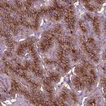 CD109 Antibody in Immunohistochemistry (Paraffin) (IHC (P))