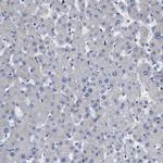 PERK Antibody in Immunohistochemistry (Paraffin) (IHC (P))